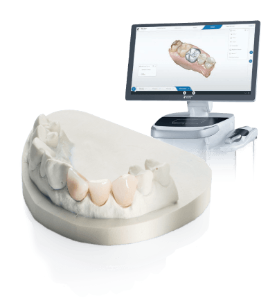 口腔内スキャナー
