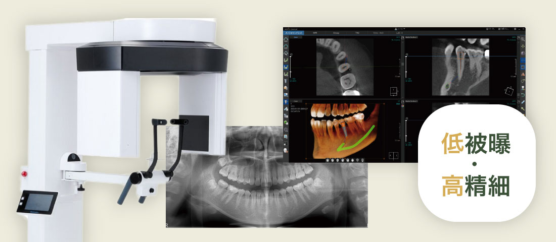 滅菌・消毒コーナー