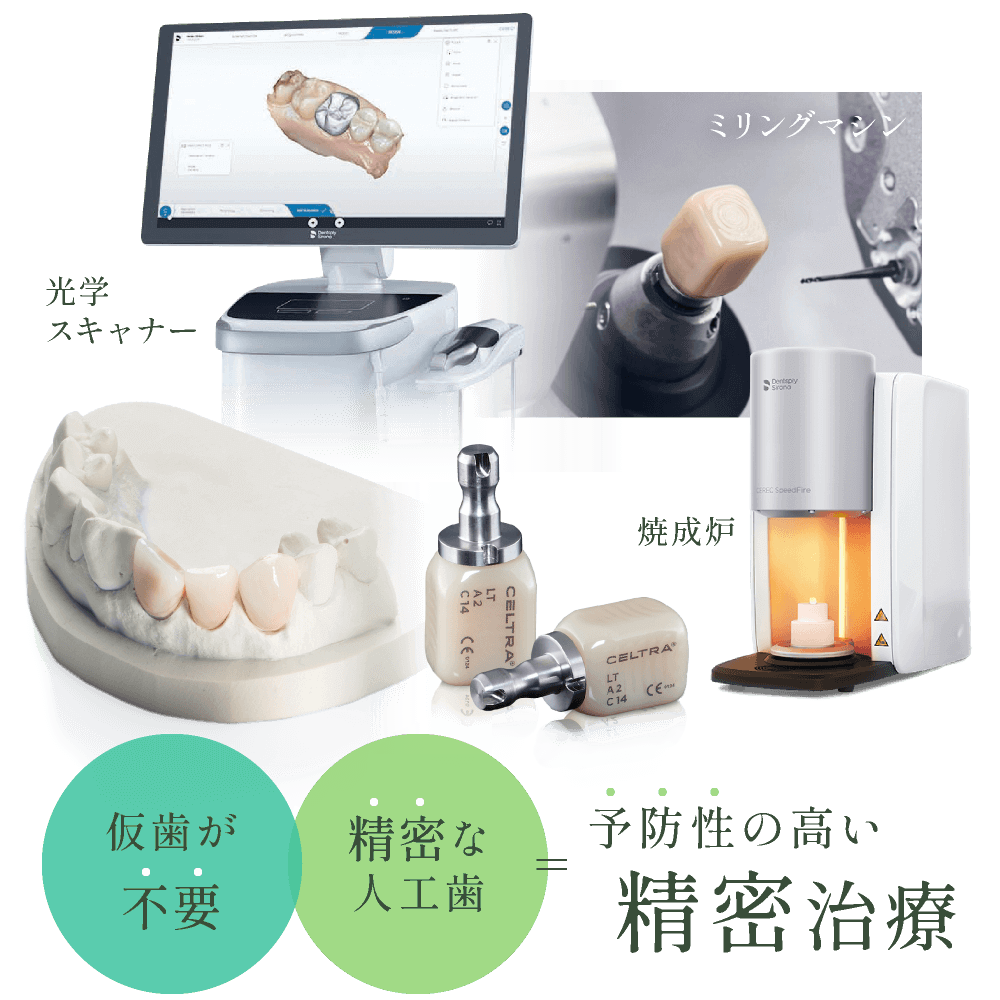 仮歯が不要×精密な人工歯=予防性の高い精密治療