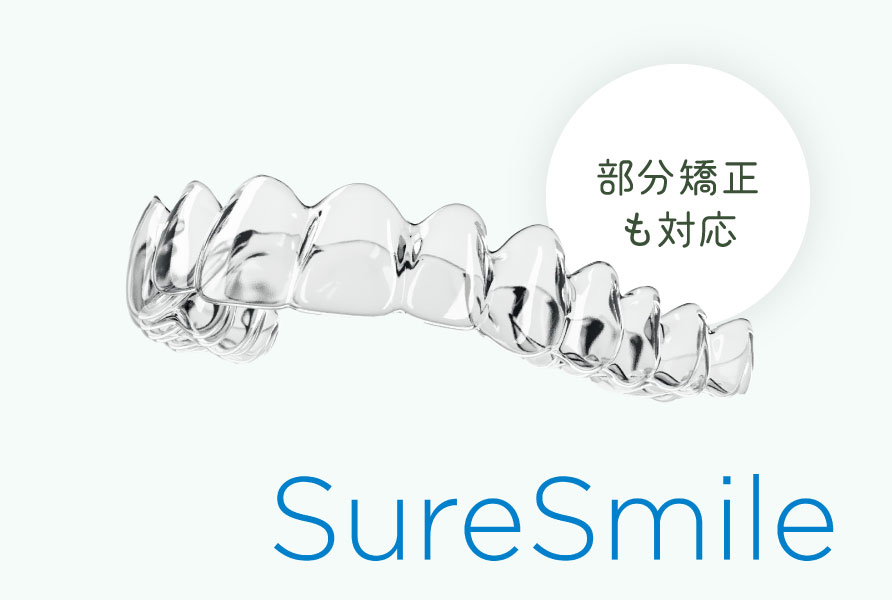 マウスピース型矯正装置(シュアスマイル)