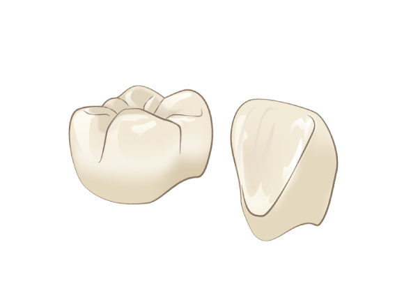 オールセラミッククラウン（ジルコニア）