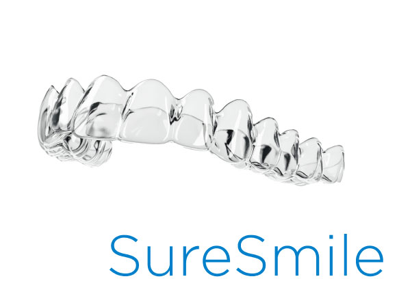 マウスピース矯正