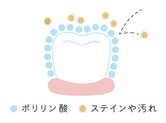 ポリリンホワイトニング